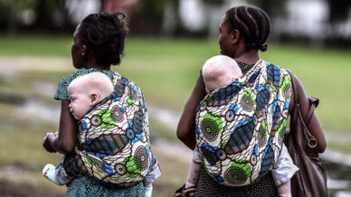 “Os albinos não têm espaço na nossa sociedade”
